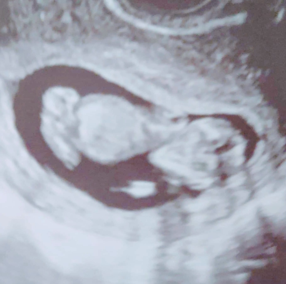 Meet your Posher, Chelsie